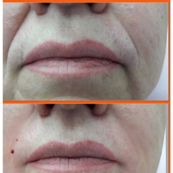 Екатерина Стельмашенко, Киев Фото - 48