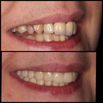 Едельвейс, Полтава Фото - 5