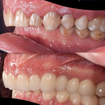 Професорська Стоматологія, Полтава Фото - 5