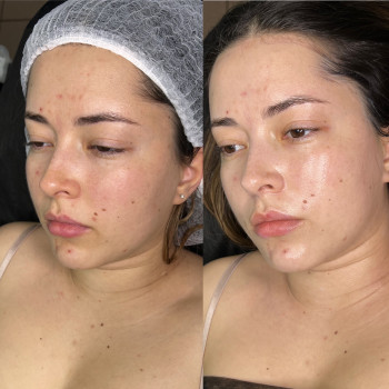 вогонь і лід