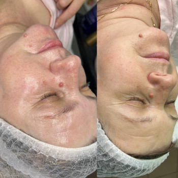 вогонь і лід