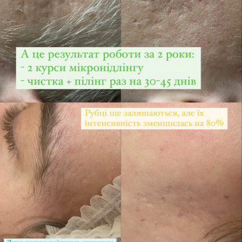 Дарʼя Кухтіна, Павлоград Фото - 9