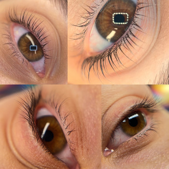 Ламінування до/після