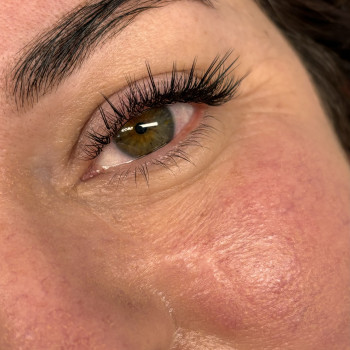 2Д з промінням