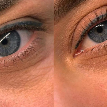 Ламінування вій до/після