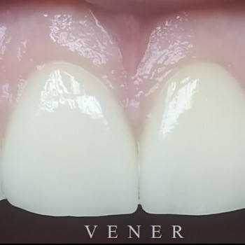 Introdent, Ровно Фото - 5