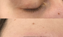 Корекція брів Салон красоты  Одесса