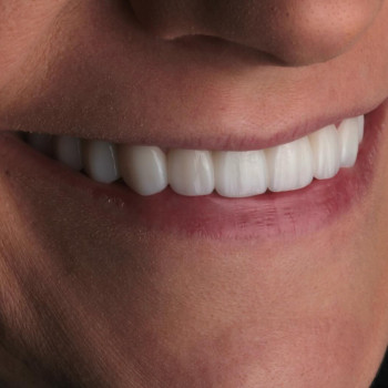 Ольга Чудинович, Ровно Фото - 5