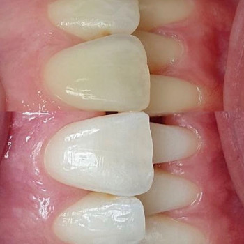 DEF, Ровно Фото - 5