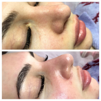 Чистка обличчя
                    Лешмейкер Алена Киев