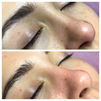 Чистка обличчя
                    Лешмейкер Алена Киев