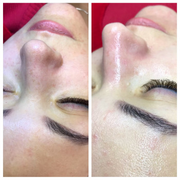 Чистка обличчя
                    Лешмейкер Алена Киев