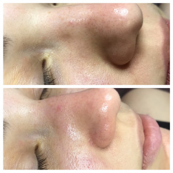 Чистка обличчя
                    Лешмейкер Алена Киев