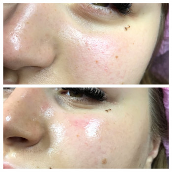 Чистка обличчя
                    Лешмейкер Алена Киев