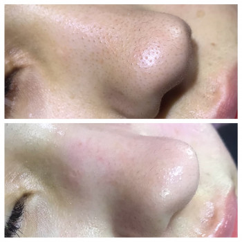 Чистка обличчя
                    Лешмейкер Алена Київ