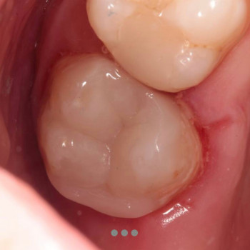 I-Dent, Ровно Фото - 5