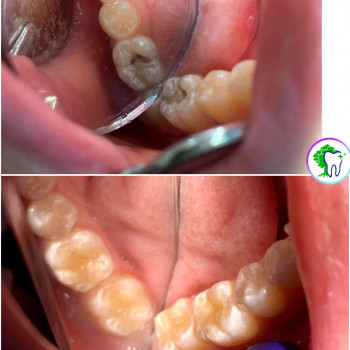 Тополь Дент, Сумы Фото - 5