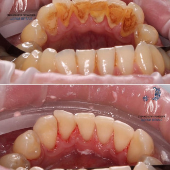 Стоматологія професора Щерби, Тернопіль Фото - 5