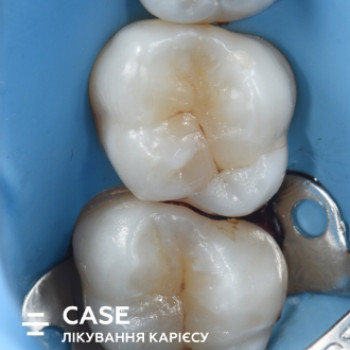 Intense, Ужгород Фото - 5