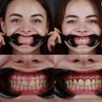 Сергій Цуперяк, Ужгород Фото - 5