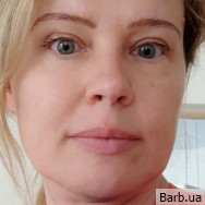 Стоматолог Олена Охримович на Barb.ua