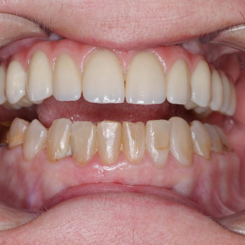 Rivis Orthodontic Clinic, Ужгород Фото - 5