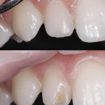 Алина Колякина, Ужгород Фото - 5