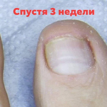 Елена Горлакова, Запорожье Фото - 21