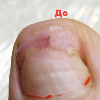 Елена Горлакова, Запорожье Фото - 22