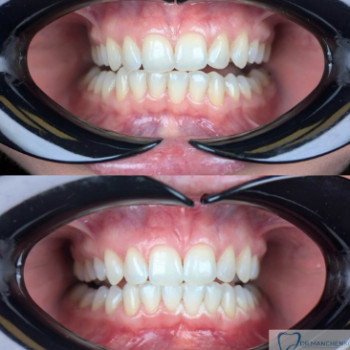 Андрій Манченко, Ужгород Фото - 5