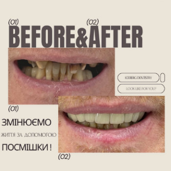 Iceberg Dentistry, Харьков Фото - 5