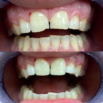 Стоматологія доктора Новікова, Харків Фото - 5