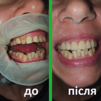 Арт Стоматологія, Харків Фото - 5