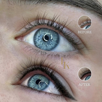 Іріс, Тернополь Фото - 18