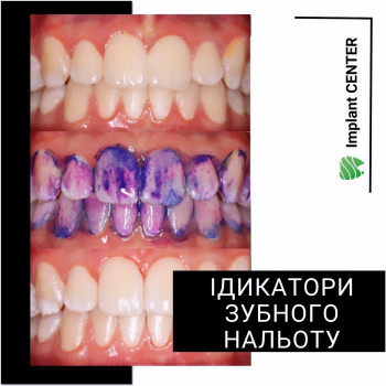 Implant, Харьков Фото - 5