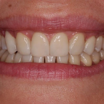 Dental Line, Харьков Фото - 5