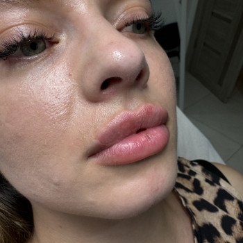 Ірина Барложецька, Ивано-Франковск Фото - 6