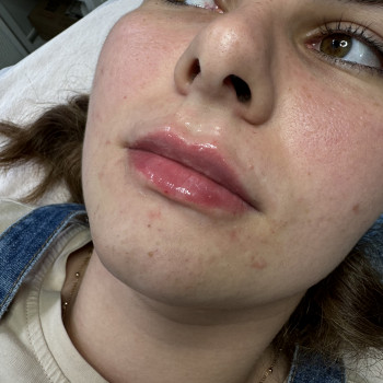 Ірина Барложецька, Ивано-Франковск Фото - 7