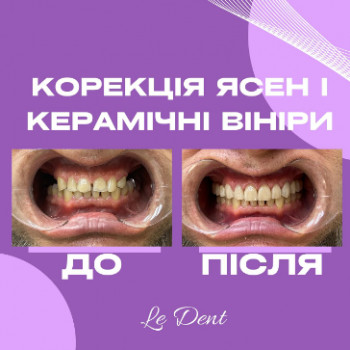 Le-dent, Харьков Фото - 5