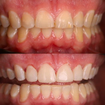 Рената Абдюшева, Харьков Фото - 5