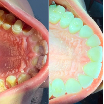 Rikkus, Харьков Фото - 5