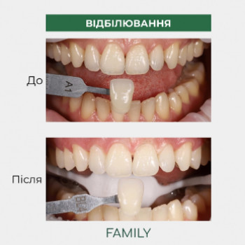 Family Dental, Хмельницкий Фото - 5