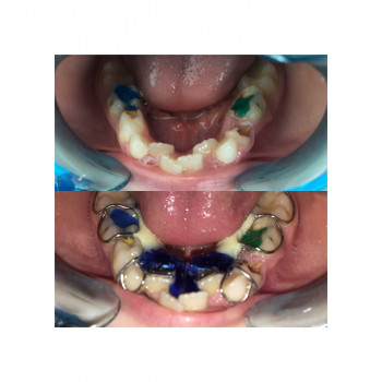 Bogos, Хмельницкий Фото - 5