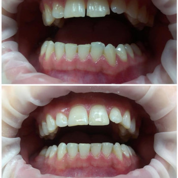 Adi-Dent, Хмельницький Фото - 6