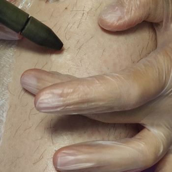 Електроепіляція
                    Косметолог Юлия Київ