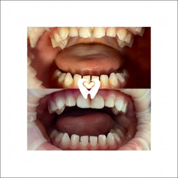 Марія Dent, Хмельницкий Фото - 5