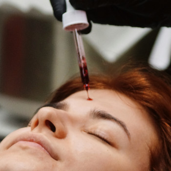 Пілінг AHA+BHA кислоти
                    Косметологический центр  Ужгород