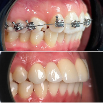 GFC, Хмельницький Фото - 5