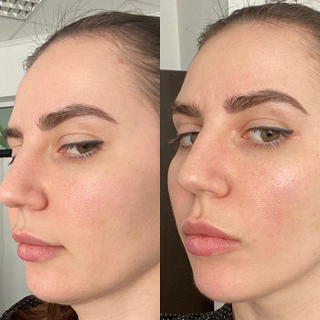 Масаж по Жаке
                    Косметологический центр  Ужгород