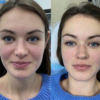 Масаж по Жаке
                    Косметологический центр  Ужгород